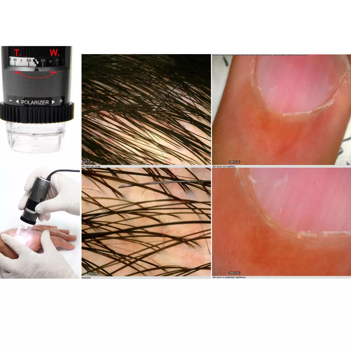 DermaScope Polarizer HR 200x Videodermatoskop